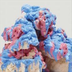 Dross Glop 1 cover art