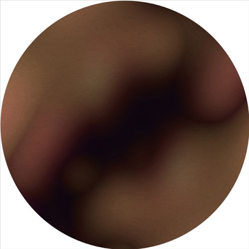 Therapy cover art
