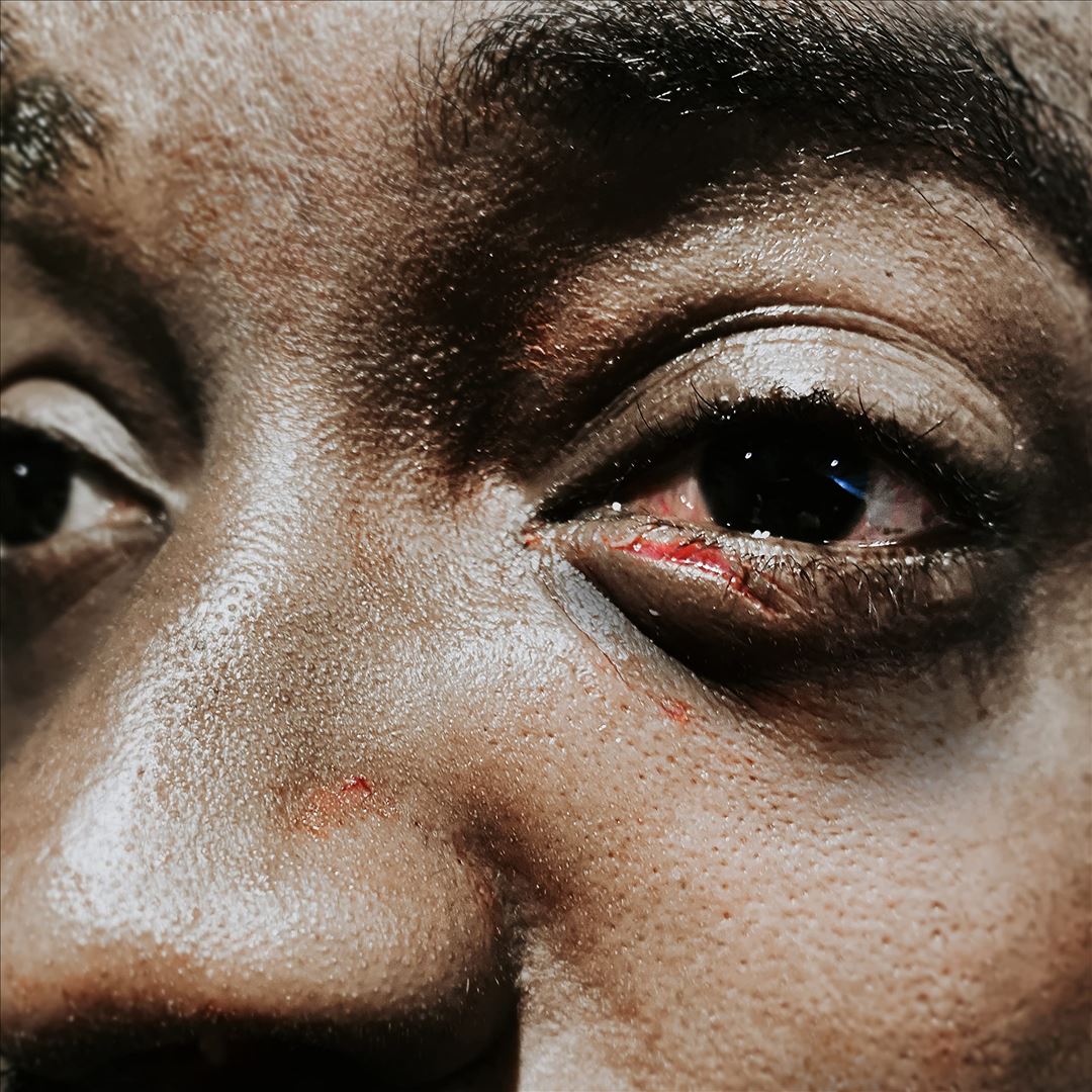 Village Is on Fire cover art