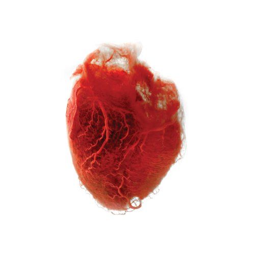 Love Is Simple cover art
