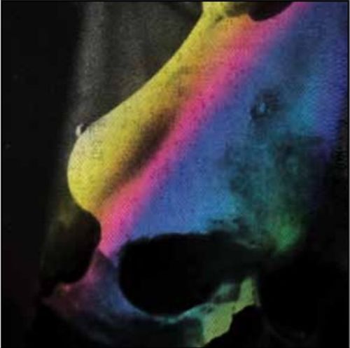 Missing cover art
