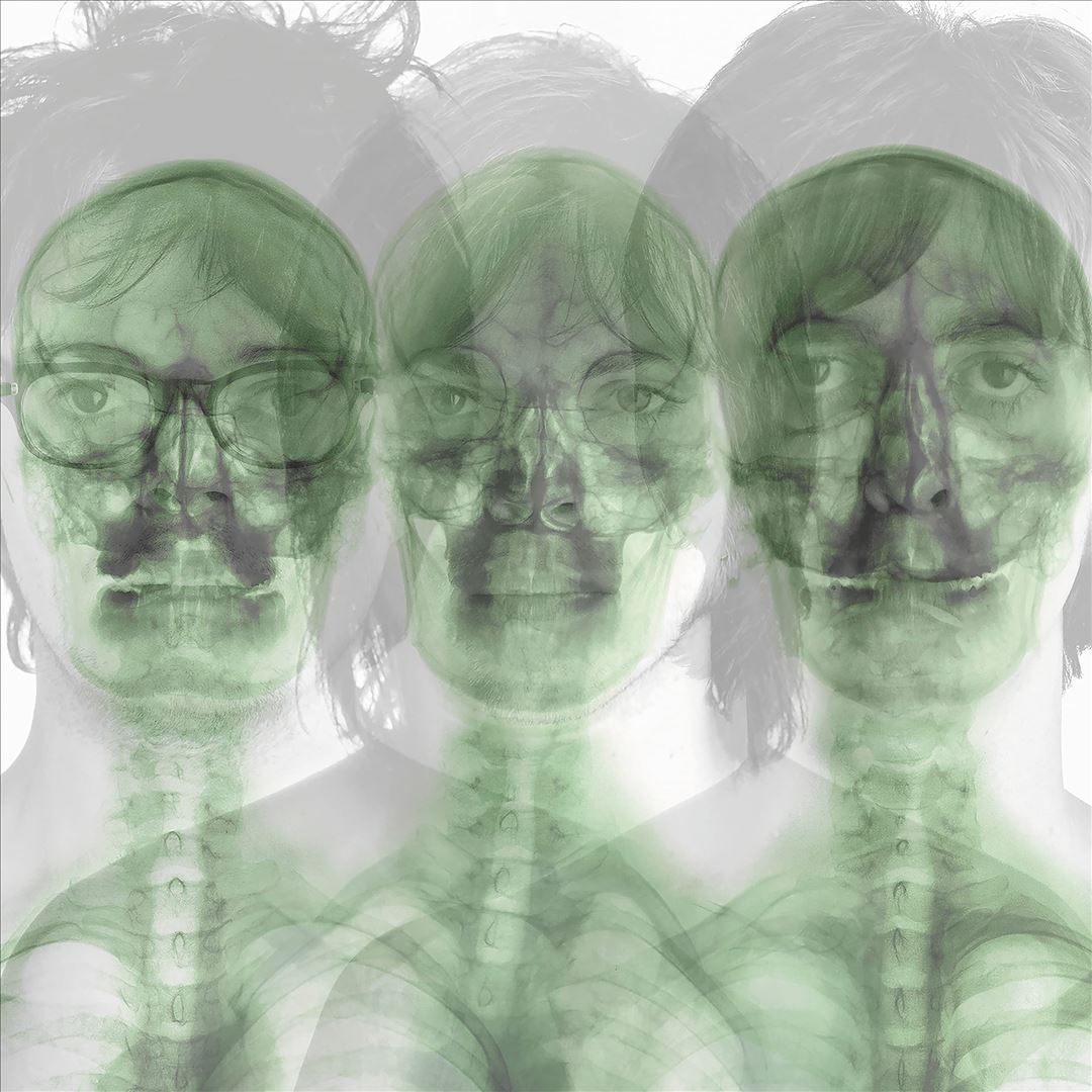 Supergrass [Neon Orange Vinyl] cover art