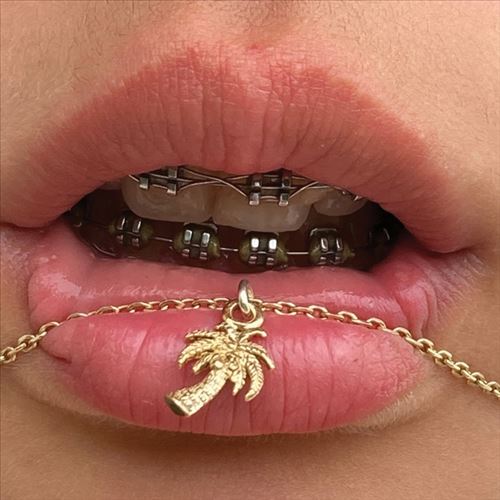 Metal. Wet cover art