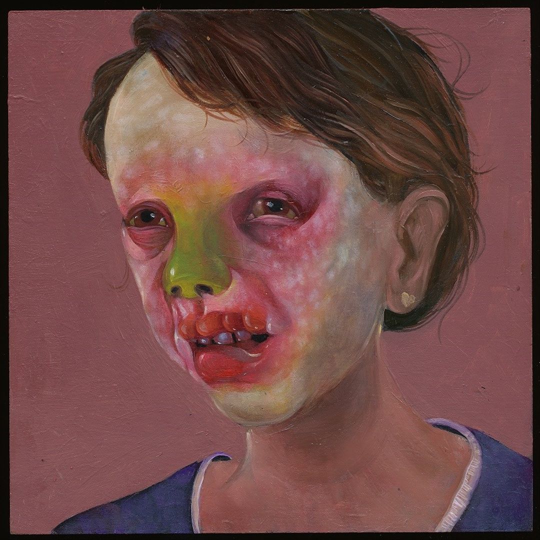 Larva Lumps and Baby Bumps cover art