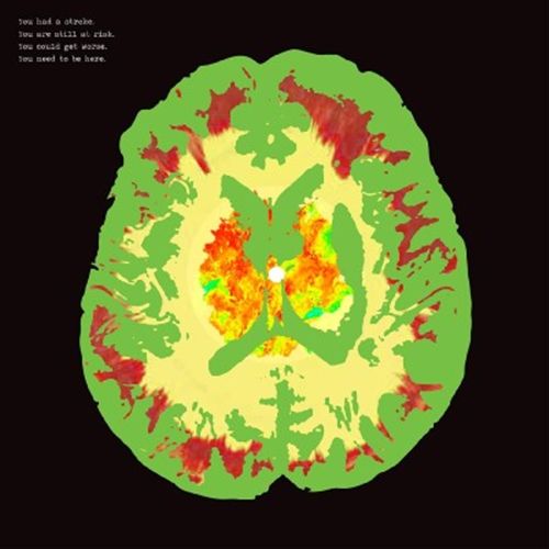 Stroke Manor cover art