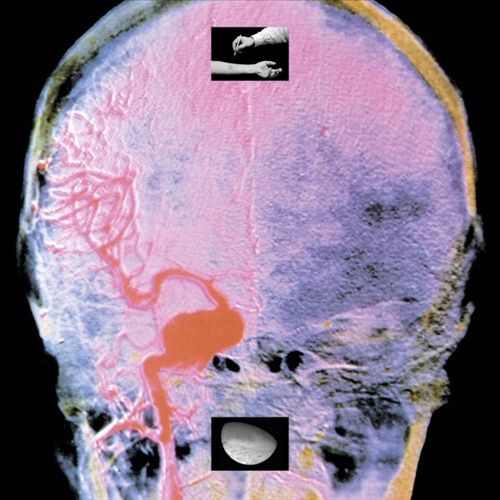 Branches on Ice cover art